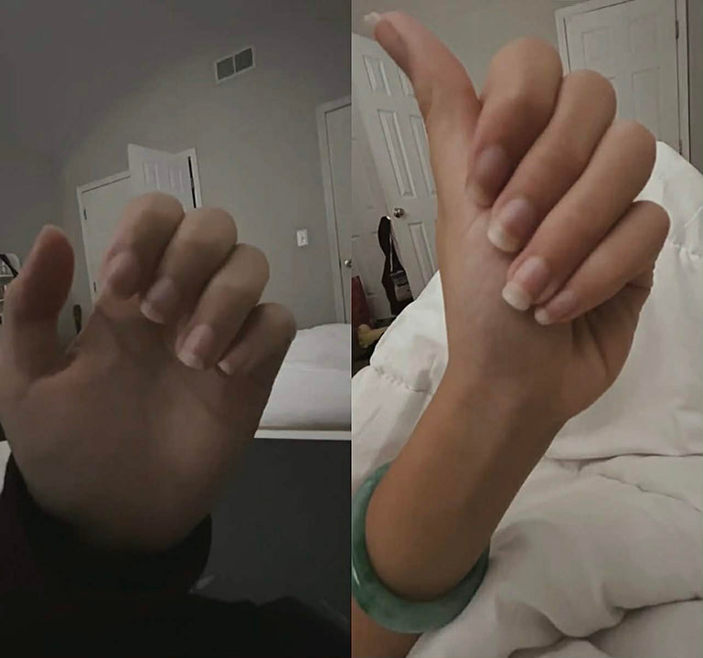 Stronger, longer and Healthier Nails After Consistent Use of nail growth oil
