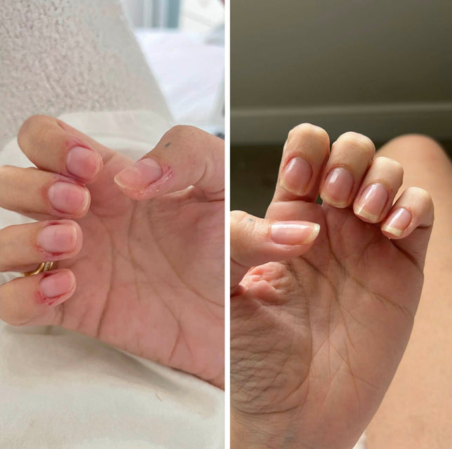 Stronger, longer and Healthier Nails After Consistent Use of nail growth oil
