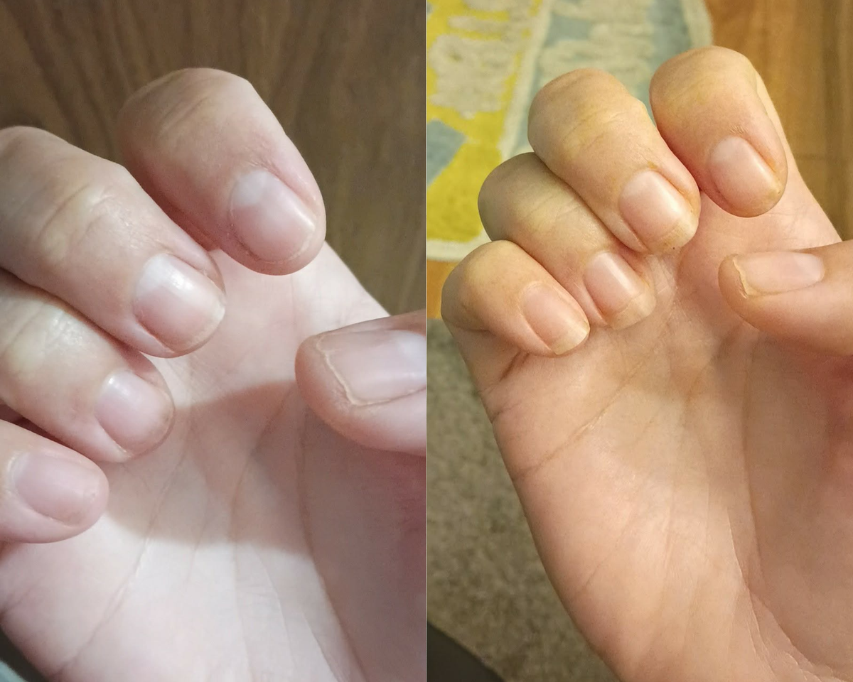 NAIL GROWTH AND STRENGTH OIL