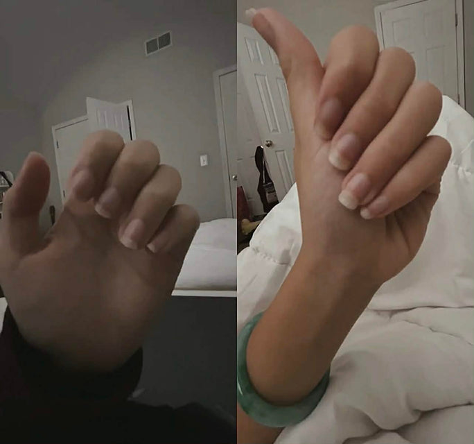 Stronger, longer and Healthier Nails After Consistent Use of nail growth oil
