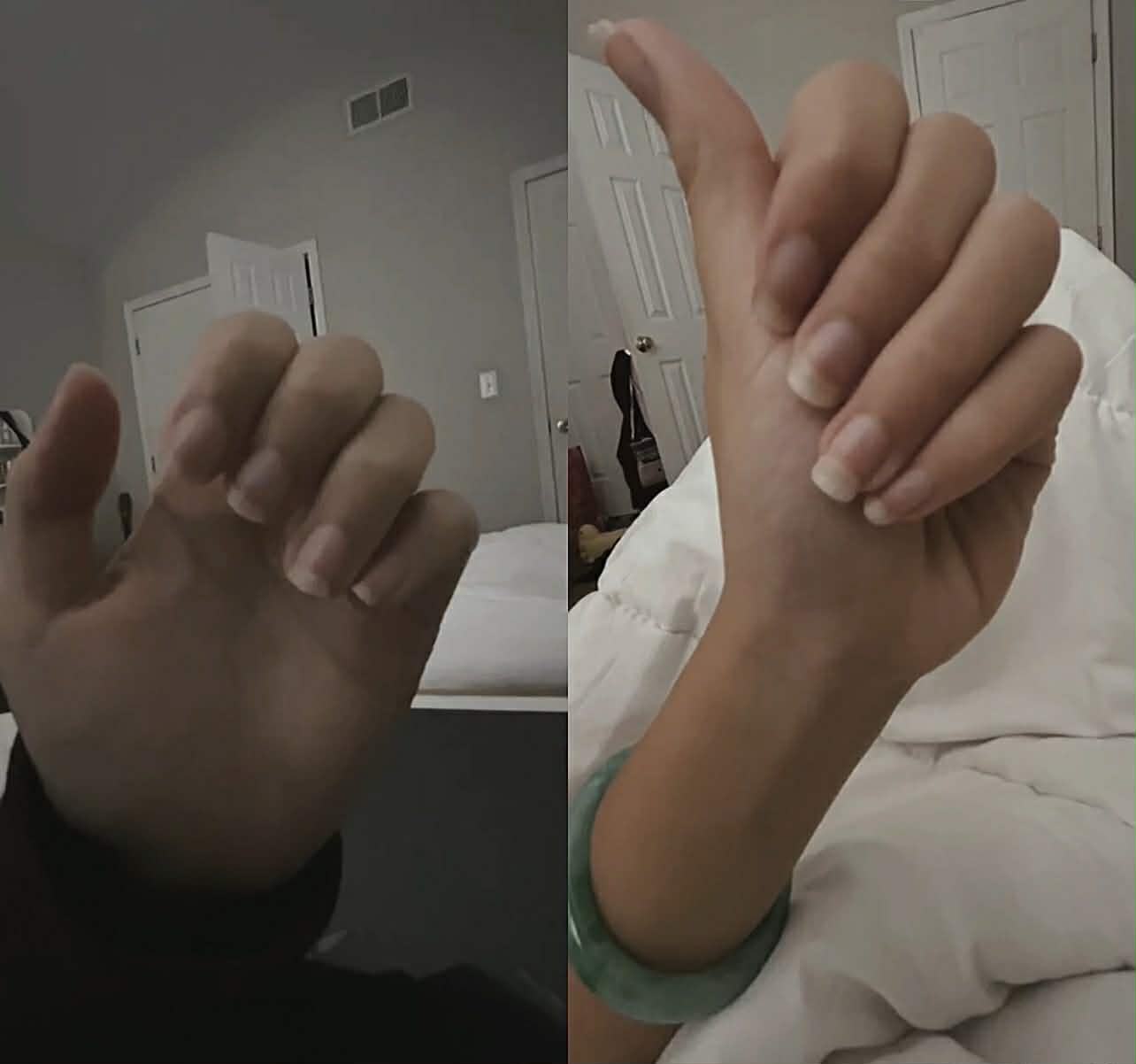 Stronger, longer and Healthier Nails After Consistent Use of nail growth oil