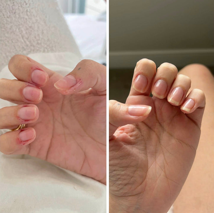 Stronger, longer and Healthier Nails After Consistent Use of nail growth oil