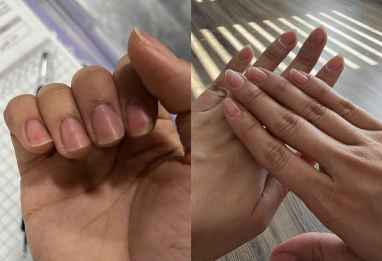 Stronger, longer and Healthier Nails After Consistent Use of nail growth oil